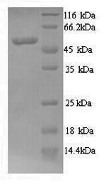 Recombinant Human N-myc proto-oncogene protein (MYCN)