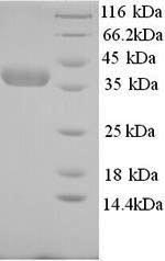 Recombinant Human Nicotinate phosphoribosyltransferase (NAPRT), partial