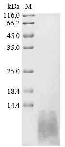 Recombinant Human Natriuretic peptides A (NPPA), partial