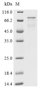 Recombinant Human Atrial natriuretic peptide receptor 1 (NPR1), partial