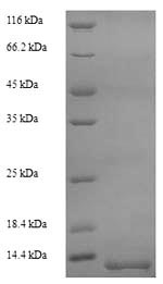 Recombinant Oncorhynchus mykiss Myelin proteolipid protein (plp), partial