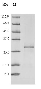 Recombinant Human Receptor-type tyrosine-protein phosphatase zeta (PTPRZ1), partial