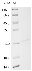 Recombinant Human Ras-related protein Rab-27A (RAB27A)