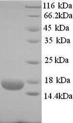 Recombinant Human Ropporin-1B (ROPN1B)