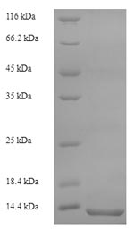 Recombinant Rat Protein S100-A8 (S100a8)