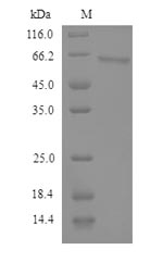 Recombinant Human Semenogelin-2 (SEMG2)
