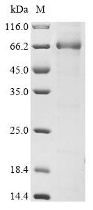 Recombinant Human Serpin B7 (SERPINB7)