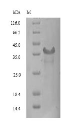 Recombinant Human Signal-regulatory protein gamma (SIRPG), partial