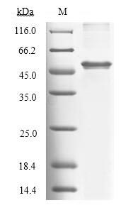 Recombinant Human Tryptophan 2,3-dioxygenase (TDO2)
