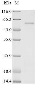 Recombinant Human immunodeficiency virus type 1 group M subtype B Virion infectivity factor (vif)