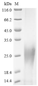 Recombinant Zaire ebolavirus Super small secreted glycoprotein (GP)