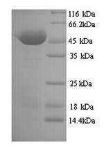 Recombinant Clostridium botulinum Botulinum neurotoxin type A (botA), partial