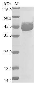 Recombinant Paeniclostridium sordellii Sialidase