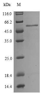 Recombinant Influenza A virus Nucleoprotein (NP)