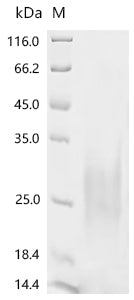 Recombinant Anguilla japonica Ventricular natriuretic peptide (vnp)