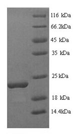 Recombinant Glycine max Stress-induced protein SAM22 (PR-10)