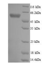 Recombinant Trypanosoma cruzi Trypanothione reductase (TPR)