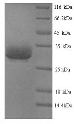 Recombinant Calloselasma rhodostoma Thrombin-like enzyme ancrod