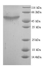 Recombinant Escherichia coli Cytosine deaminase (codA)