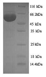 Recombinant Influenza A virus Nucleoprotein (NP)
