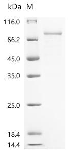 Recombinant Plasmodium falciparum Circumsporozoite protein (CSP), partial