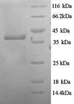 Recombinant Escherichia coli Hygromycin-B 4-O-kinase (hph)