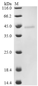 Recombinant Human adenovirus C serotype 2 Early E4 34 kDa protein