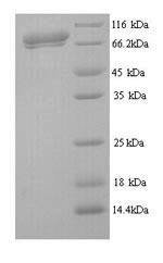 Recombinant Influenza C virus Hemagglutinin-esterase-fusion glycoprotein (HE), partial