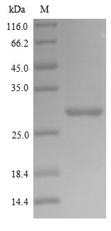 Recombinant Influenza A virus Polymerase acidic protein (PA), partial
