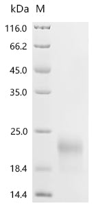 Recombinant Macaca fascicularis Jacalin-type lectin domain-containing protein, partial