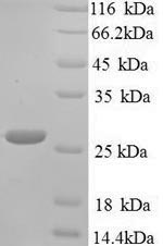 Recombinant Klebsiella pneumoniae Metallo-beta-lactamase type 2 (blaNDM-1)