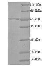 Recombinant Bacillus subtilis 3-oxoacyl-[acyl-carrier-protein] synthase 2 (fabF)