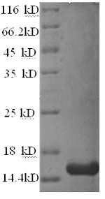 Recombinant Rat Prolactin-inducible protein homolog (Pip)
