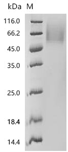 Recombinant Human MHC Class I chain-related protein (MICA), partial