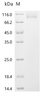 Recombinant Porcine epidemic diarrhea virus Spike glycoprotein(S), partial