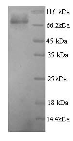 Recombinant Human Glucokinase regulatory protein (GCKR)