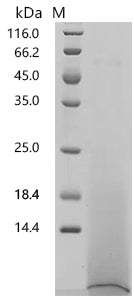 Recombinant Chlamydia trachomatis serovar L2 Histone H1-like protein HC2 (hctB)