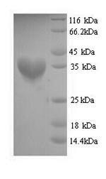 Recombinant Staphylococcus aureus Malonyl CoA-acyl carrier protein transacylase (fabD)