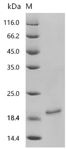 Recombinant Mouse Non-selective voltage-gated ion channel VDAC2 (Vdac2), partial