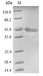 Recombinant Human Protein FAM46C (FAM46C)