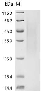 Recombinant Human Zinc finger CCCH domain-containing protein 14 (ZC3H14)