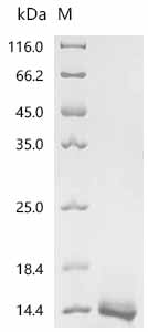 Recombinant Human Single Ig IL-1-related receptor(SIGIRR), partial