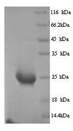 Recombinant Human Butyrophilin subfamily 2 member A1 (BTN2A1), partial