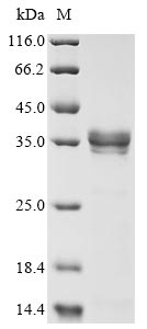 Recombinant Human metapneumovirus Matrix protein (M)