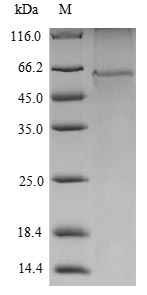 Recombinant Mouse Serine/threonine-protein kinase VRK1 (Vrk1)