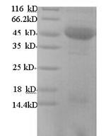 Recombinant Human m7GpppN-mRNA hydrolase (DCP2)