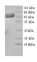 Recombinant Mouse Hydroxymethylglutaryl-CoA synthase, Cytoplasmic domain (Hmgcs1)