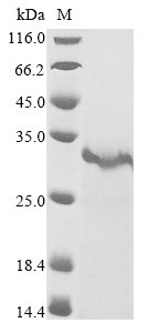Recombinant Crotalus atrox Snake venom serine protease catroxase-2