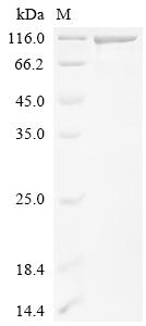 Recombinant Human E3 ubiquitin-protein ligase DTX3L (DTX3L)