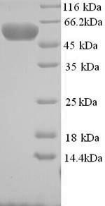 Recombinant Human E3 ubiquitin-protein ligase MYLIP (MYLIP)